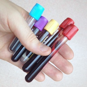 Laboratory tubes of blood