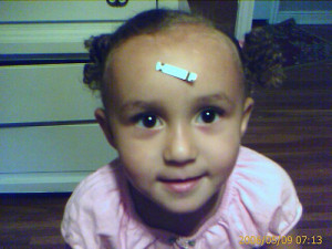 My daughter with a test strip stuck to her forehead