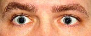 dilated-eyes