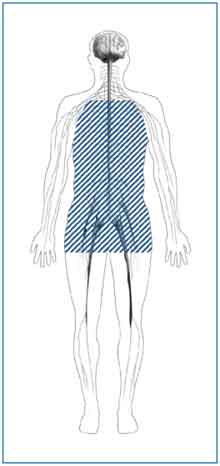 Image showing the region of the body affected by autonomic neuropathy